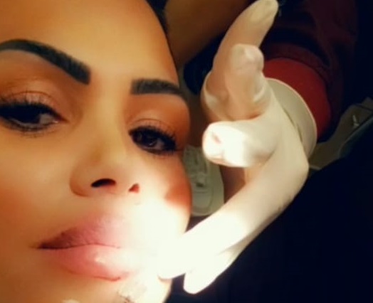 MC Sexy faz preenchimento labial e aplica botox: “rostinho de bebê”